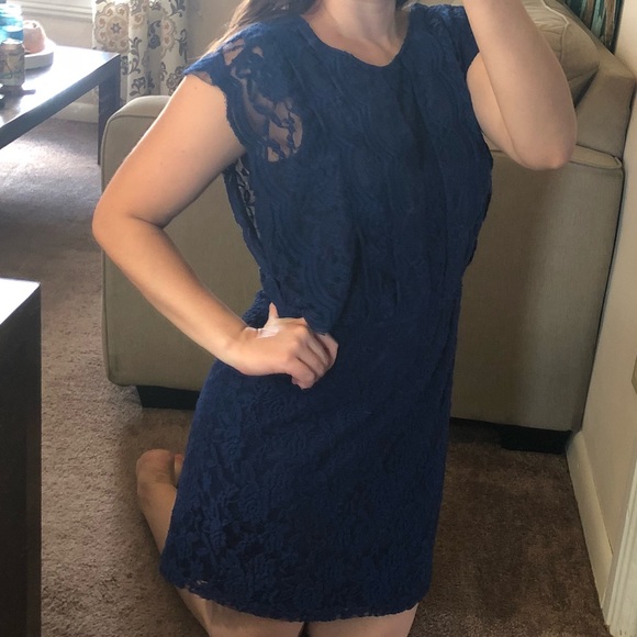 Blue lace dress - Picture 2 of 5
